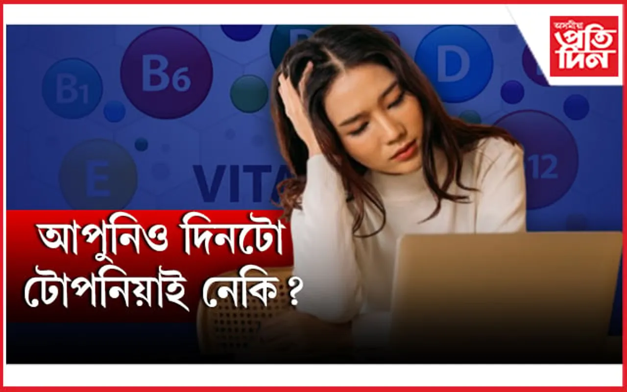 টোপনিয়ে সমস্যাত পেলাইছে নেকি?